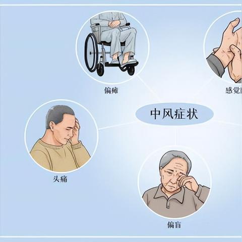 脑中风的先兆有哪些（脑中风的先兆是什么）